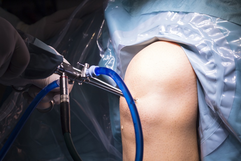 Cirugía artroscópica de rodilla